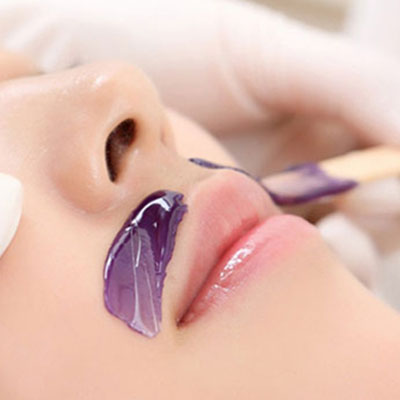 [Lẻ]Triệt ria mép