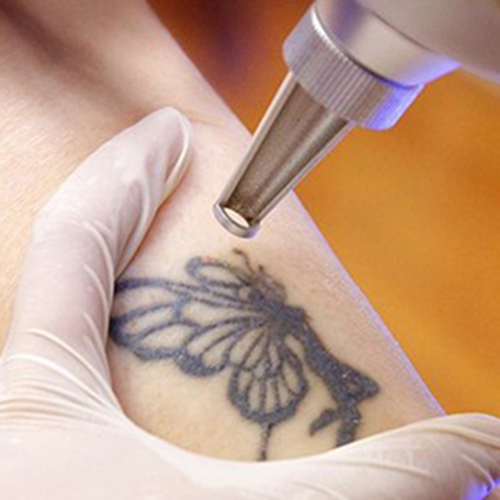 [BH - Xanh, Đen] Xóa hình xăm diện tích 11-15 (Cm)