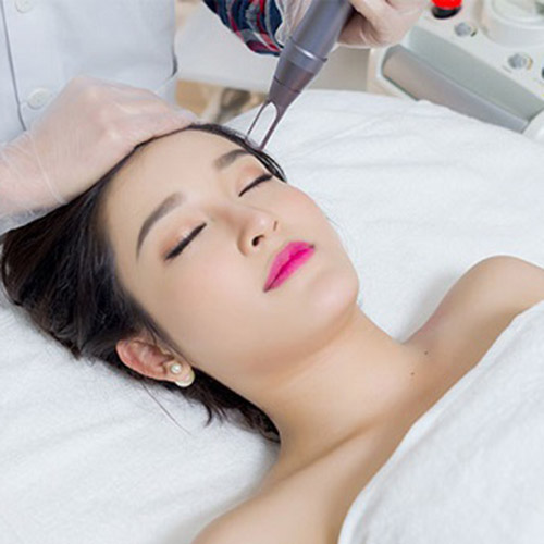 [Lẻ] Bắn nám (Toning) Không trẻ hóa